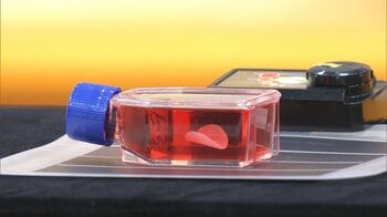 【衝撃】1年以内に実用化も？iPS細胞由来の「心筋細胞シート」が承認申請　重症患者の治療にも期待「心臓移植を回避できるかも」