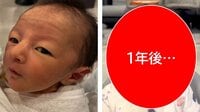 「変化がすごい」“おじさん顔ベビー”1年後の姿に「どういう成長」驚きの声続々！“アイドル級”くりくりおめめのきょとん顔にメロメロ！【激かわキッズ奇跡の瞬間】