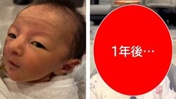 「変化がすごい」“おじさん顔ベビー”1年後の姿に「どういう成長」驚きの声続々！“アイドル級”くりくりおめめのきょとん顔にメロメロ！【激かわキッズ奇跡の瞬間】