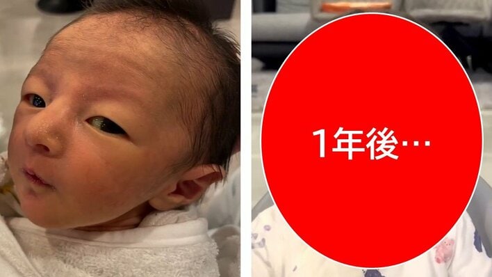 「変化がすごい」“おじさん顔ベビー”1年後の姿に「どういう成長」驚きの声続々！“アイドル級”くりくりおめめのきょとん顔にメロメロ！【激かわキッズ奇跡の瞬間】