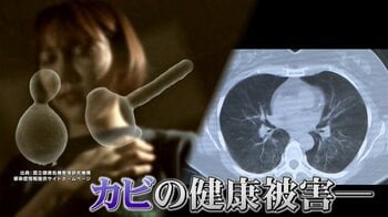 【要注意】カビ吸い込み“夏肺炎”の恐れ…高温多湿の季節にご用心！急に“甘いもの”が食べたくなったら危険のサイン？