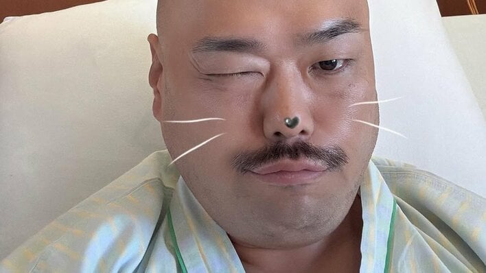 クロちゃん 発声禁止で病室からフリップ芸も 声帯ポリープ切除手術報告に心配の声「NEWクロちゃんを待っててだしん！！」