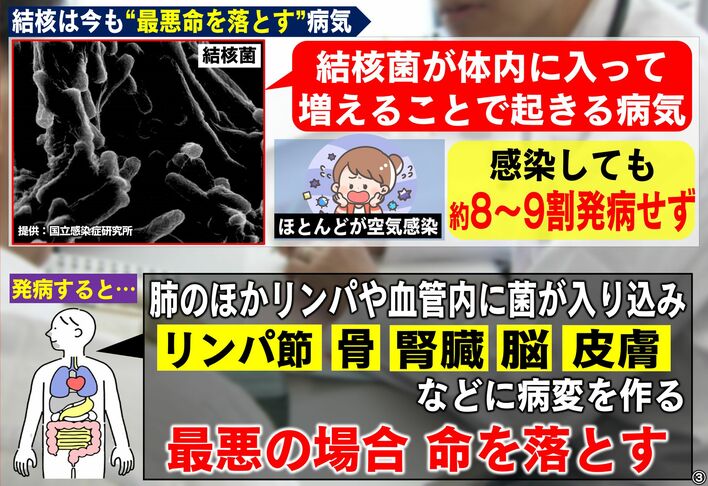 JOYも発病「死ぬかと…」福島の高齢者施設で「結核」集団感染 今でも