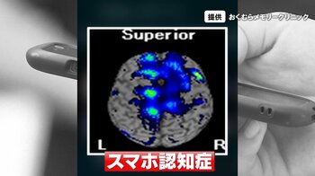 【スマホ認知症】予備軍1000万人か？長時間スマホ使用で脳が“ゴミ屋敷”に…記憶だけでなくコミュニケーションにも影響