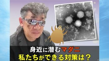 【注意】身近に潜む“殺人マダニ”…感染症SFTSで死者も 特徴と対策は？ダニ専門家が解説