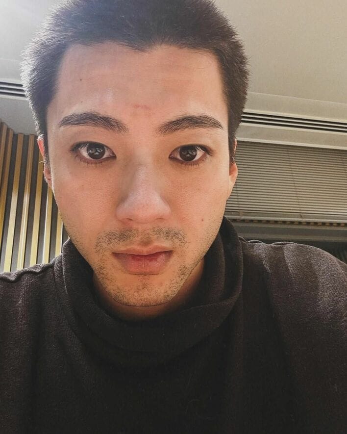 山田裕貴が最強の男に！？ 眉間に『鬼滅の刃』のような“痣”発現で