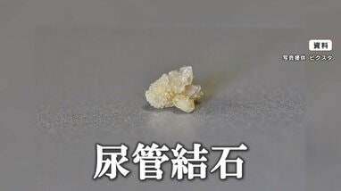 注意】猛暑で「尿路結石」の患者が急増！理由は“脱水” 谷原章介も3年前