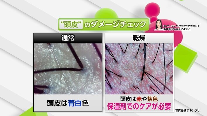 【悩み】1日何本抜けても大丈夫？猛暑などで髪＆頭皮にダメージ…秋の髪ケア 気になるギモンを専門家が解説